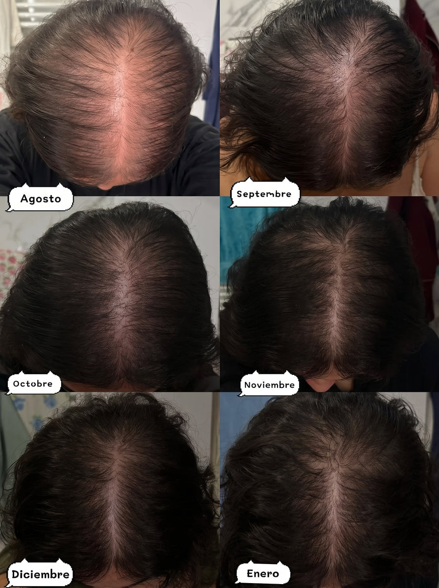 Evolución del cabello durante varios meses